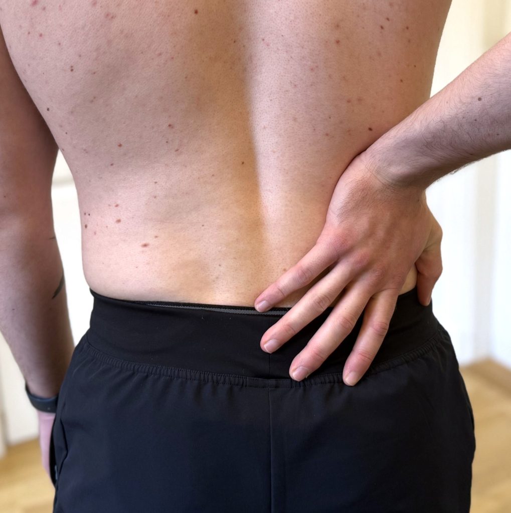 ländrygg ryggskott lumbago